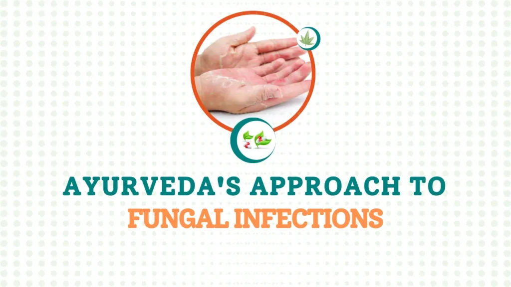 Ayurveda's Approach to Fungal Infections