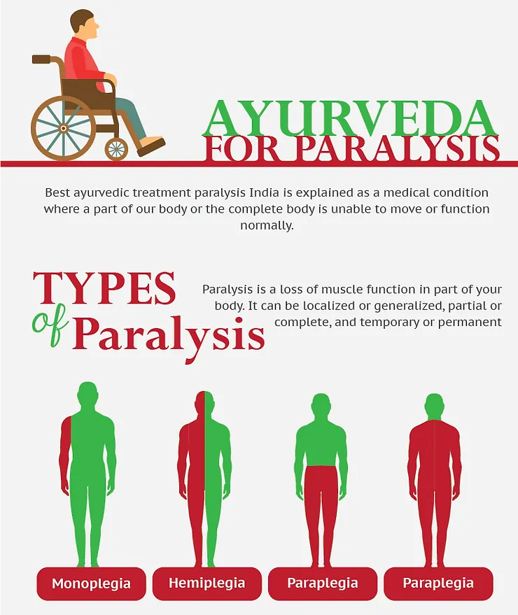 Paralysis Treatment in Ayurveda