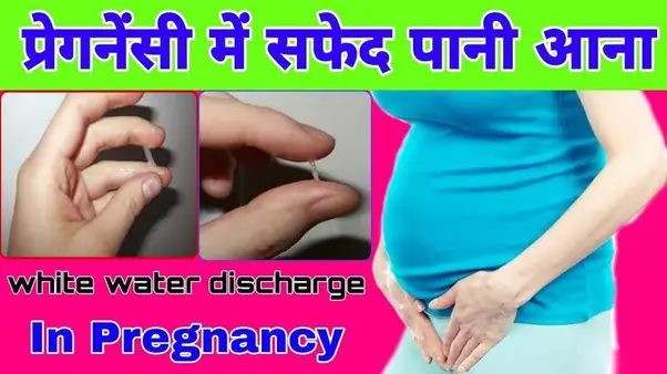 White Discharge Problem in Pregnancy