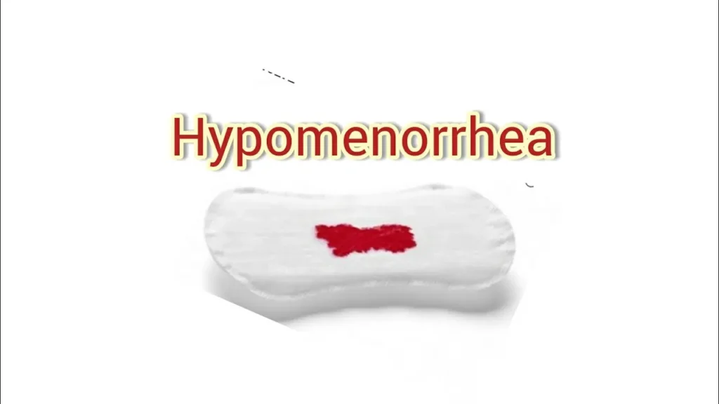 hymenorrhoea